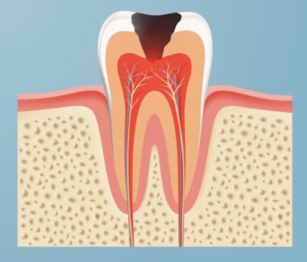 <p>Dorsal Cavity</p>