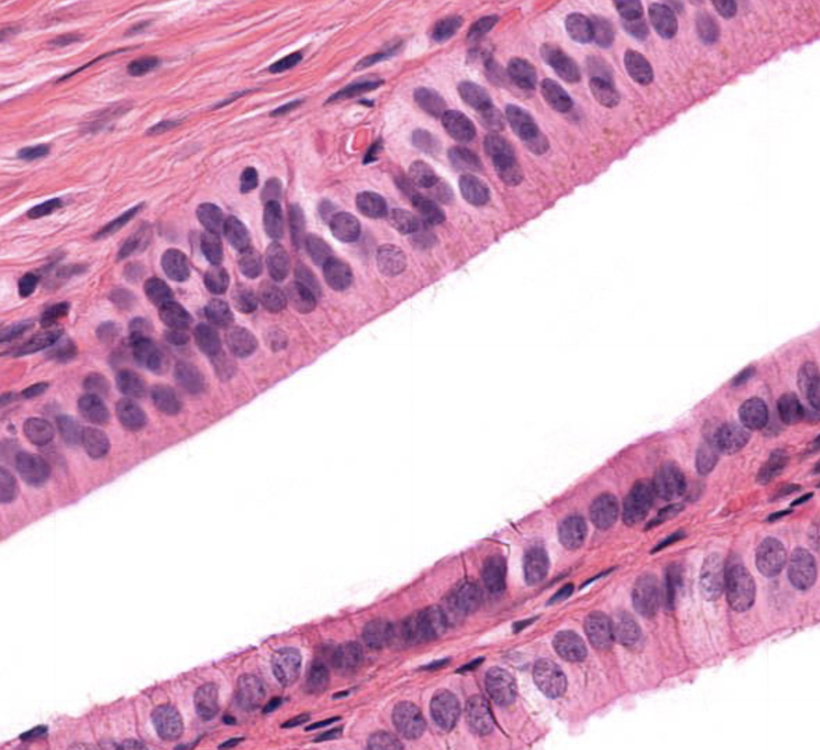 <p>tissue type</p>