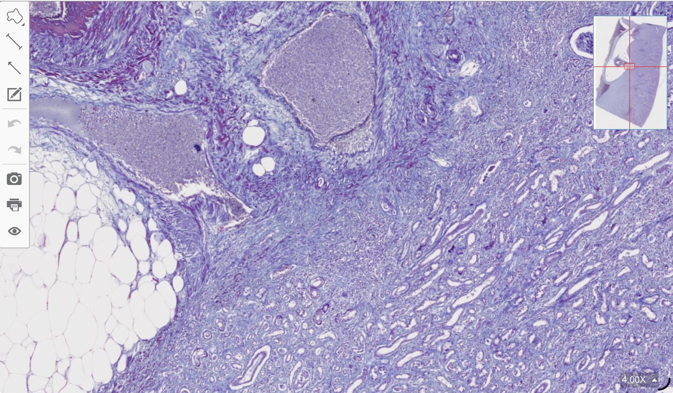 term image