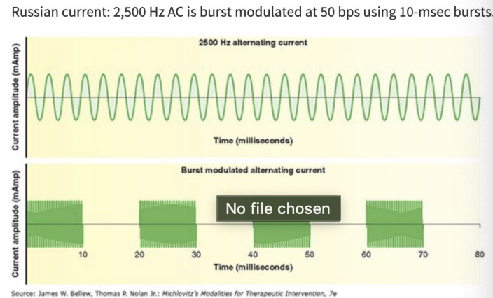<ul><li><p>variation of AC </p></li><li><p>activates skeletal muscle </p></li><li><p>burst* modulation - defining characteristic </p></li><li><p>2,500 Hz (carrier frequency) alternating sinusoidal current that is interrupted &amp; delivered in short bursts </p></li><li><p>50 bps using 10-msec bursts </p></li><li><p>10/50/10</p></li><li><p>actual duty cycle = 16.7% </p></li><li><p>relative duty cycle = 50% </p><ul><li><p>current is flowing half of the time </p></li></ul></li></ul><p></p>