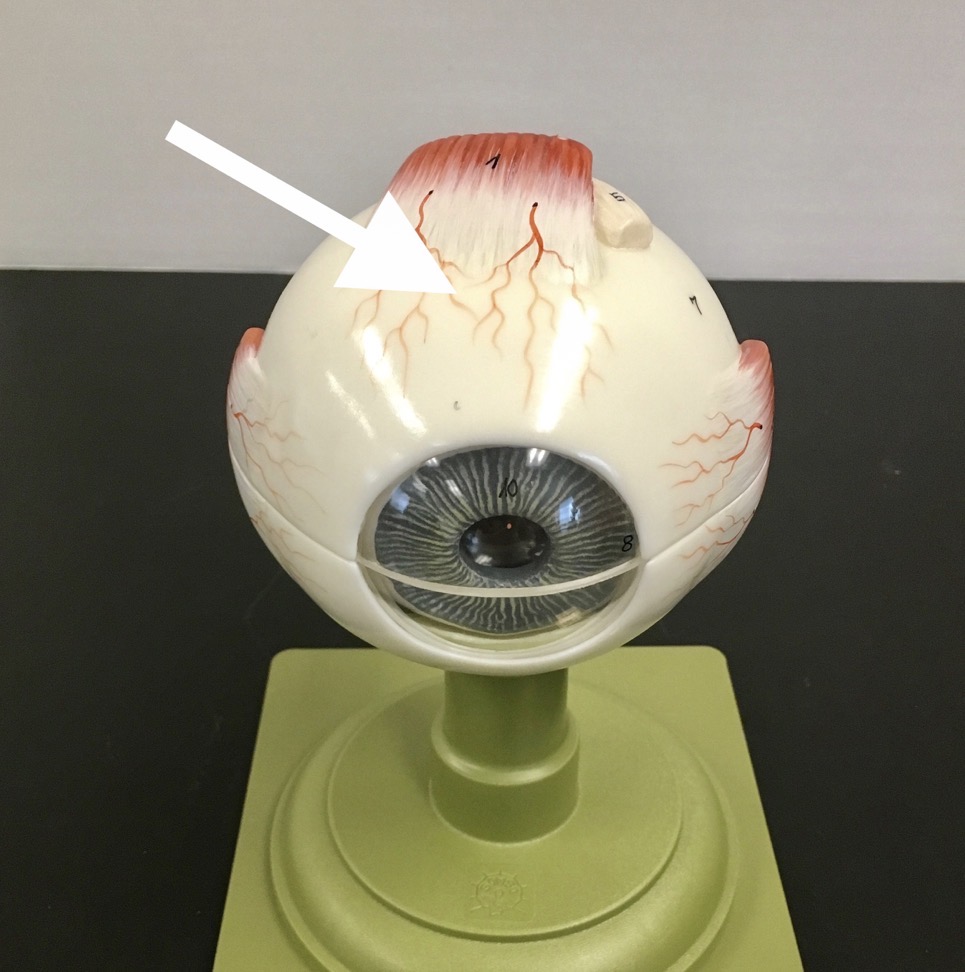 <p><span>name the red vascular structure at the end of the arrow's point</span></p>