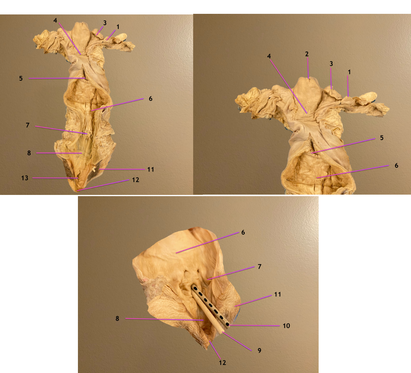 <p>pic 1/2: dorsal view of cow repro tract</p><p>pic 3: close up of vaginovestibular junction</p><p>.</p><p>label the opening 9, 10</p><p>label 13</p>