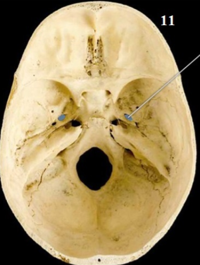 <p>Name This Foramen and what passes through it</p>