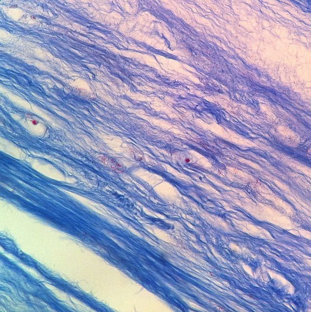 <p><mark>the toughest and strongest type of cartilage in the body</mark><span>.</span></p>
