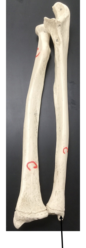 <p>What bone and bone feature is this?</p>