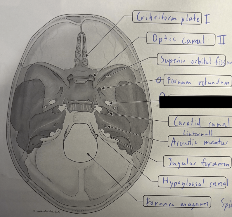 <p>Trigeminal V3</p>