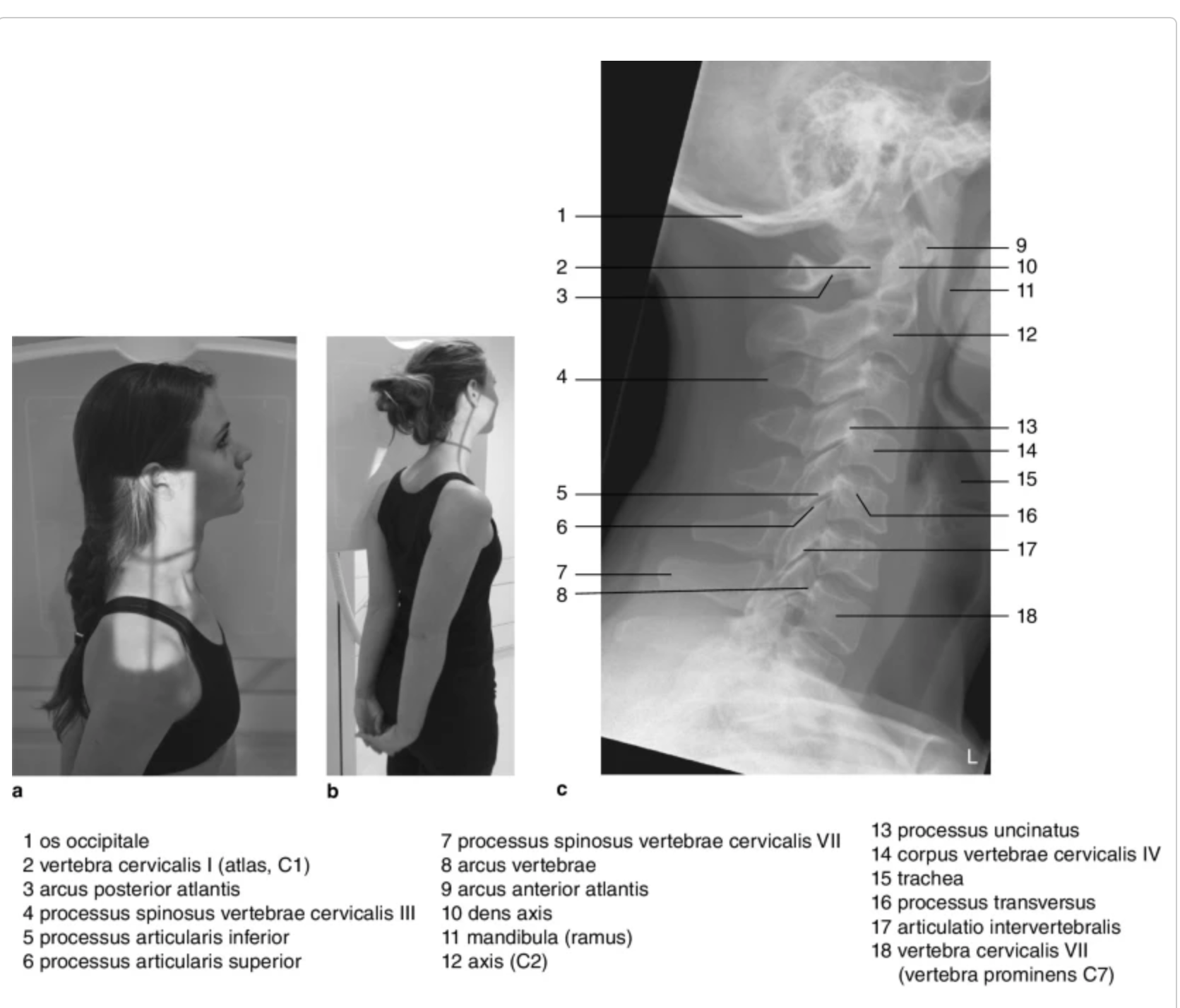 <p>processus spinosus</p>