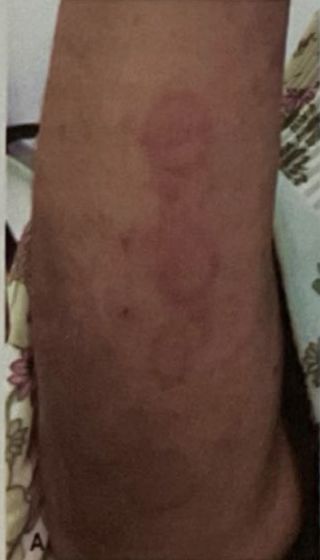 <p>CHẨN ĐOÁN?</p>