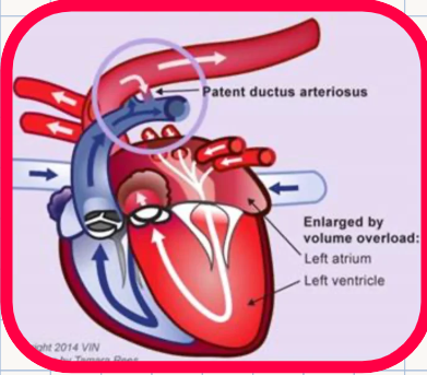 <p>Patent Ductus Arteriosus (PDA)</p><p>List the 4 sequential cardiopulmonary consequences that develop directly due to the left-to-right shunt in PDA:</p>