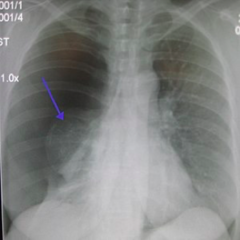 <p>what is the diagnosis?</p>
