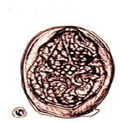 <p><span>Non-operculated with minute lateral spine. Tissue or red cells maybe adherent. Size is 70-105 x 50-80 um</span></p>