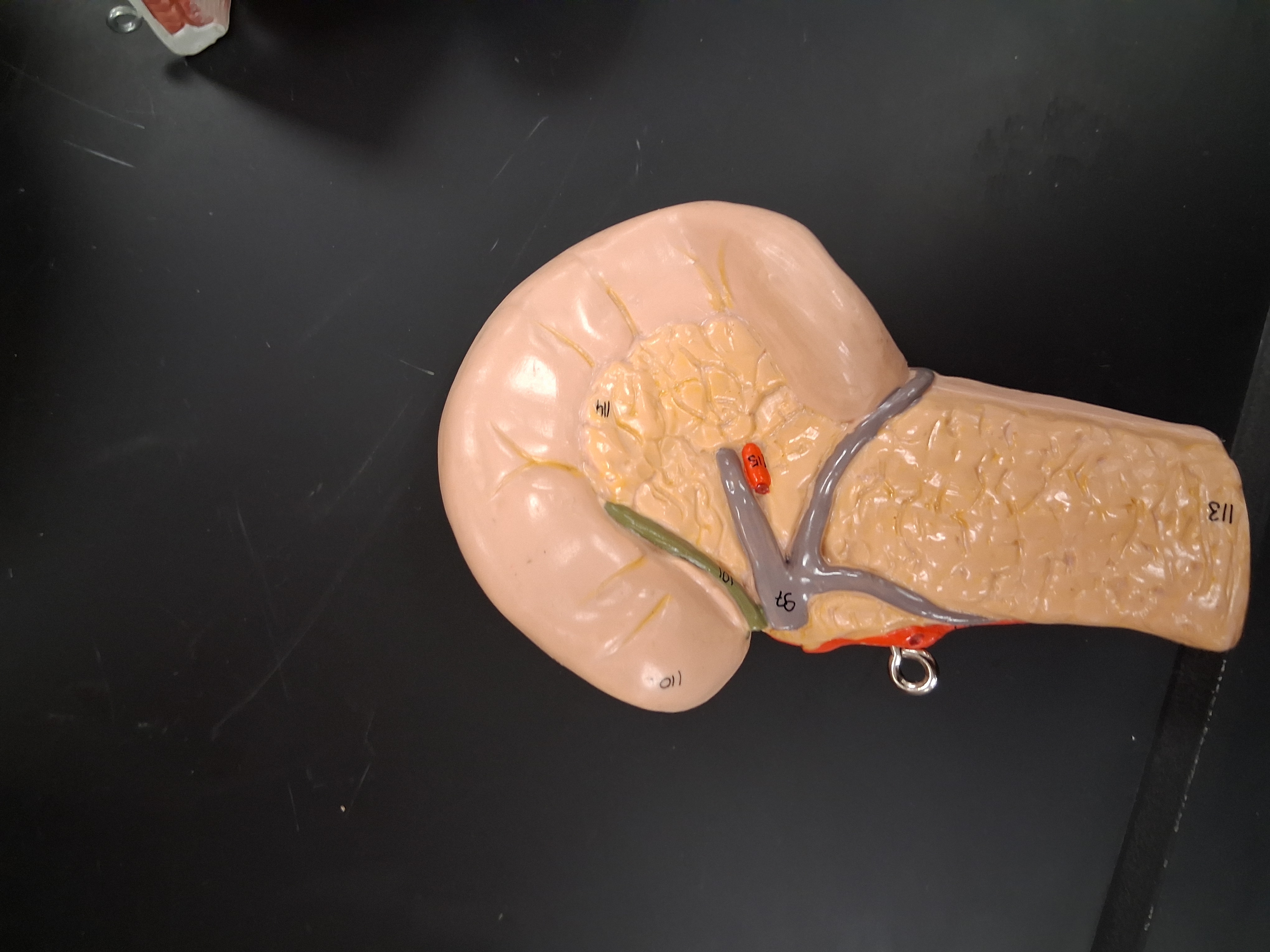 <p>Duodenum?</p>
