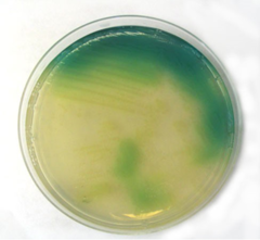 <p>- Blue-green</p>