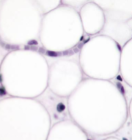 <p>CT Proper Loose:</p><p>Adipose Tissue</p>