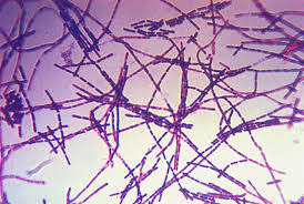 <p>gram + rods (aligned end-to-end in chains) spore-forming</p>