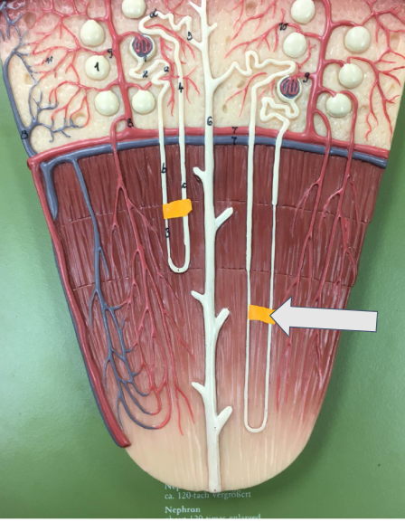 <p>Name this type of nephron</p>