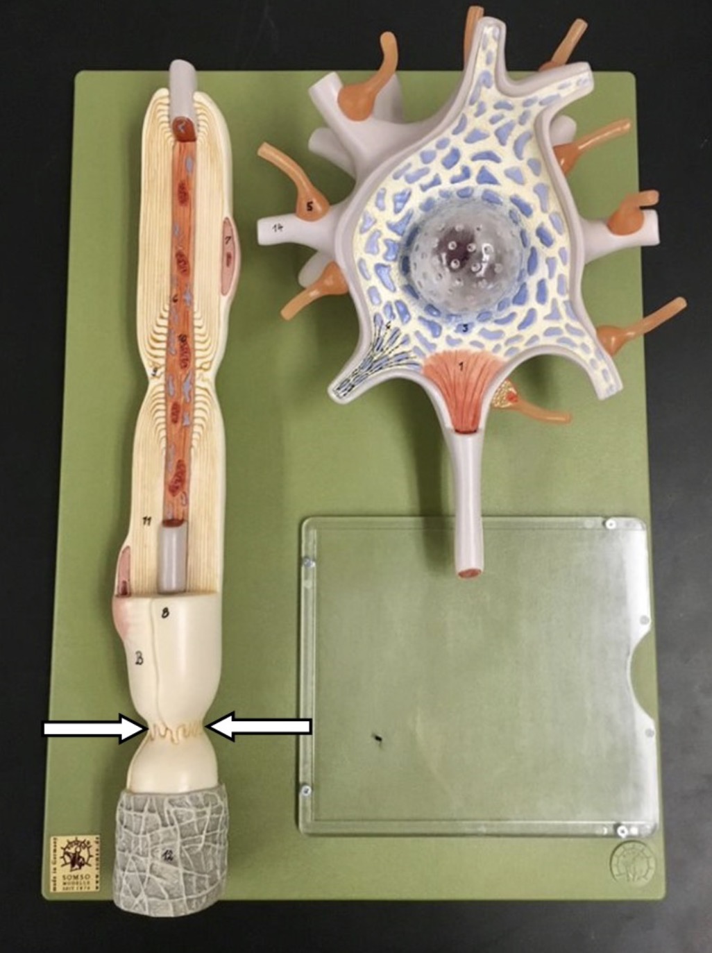 <p>What is the arrow pointing to?</p>