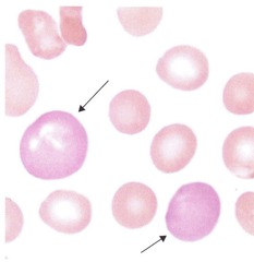 <p>Wright stain</p>