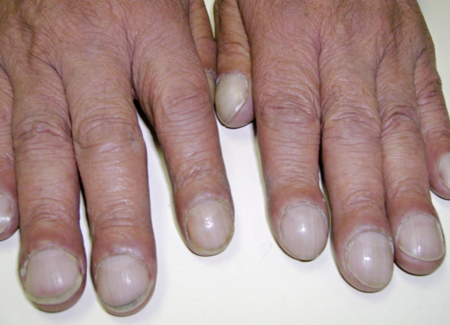 <p>What is this? What is it a sign of?</p>