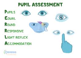 <p>Pupils Equal To Light and Accommodation </p>