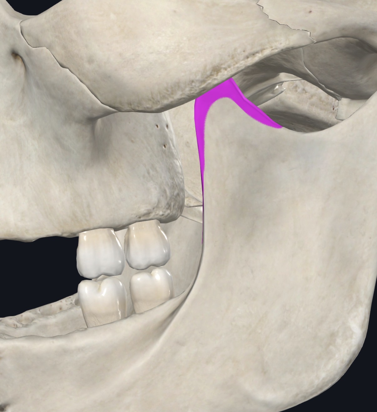 <p>Narrow attachment to tip and medial surface of coronoid process and anterior border of ramus of mandible</p>