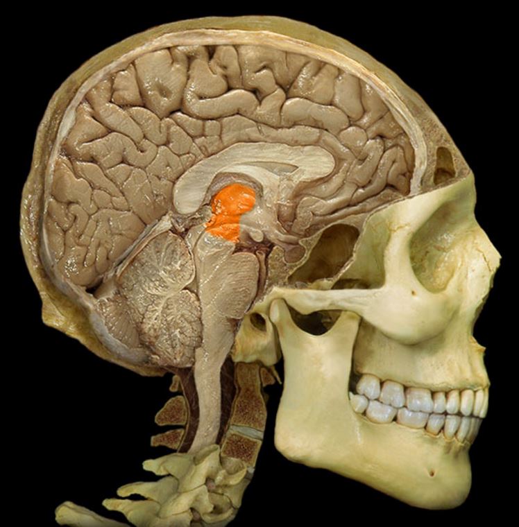 term image