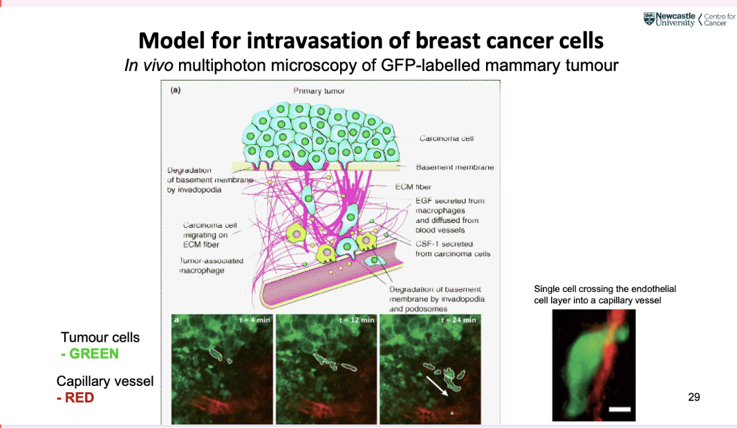 <p>in vivo multiphoton microscopy of GFP labelled mammary tumour</p><p></p>