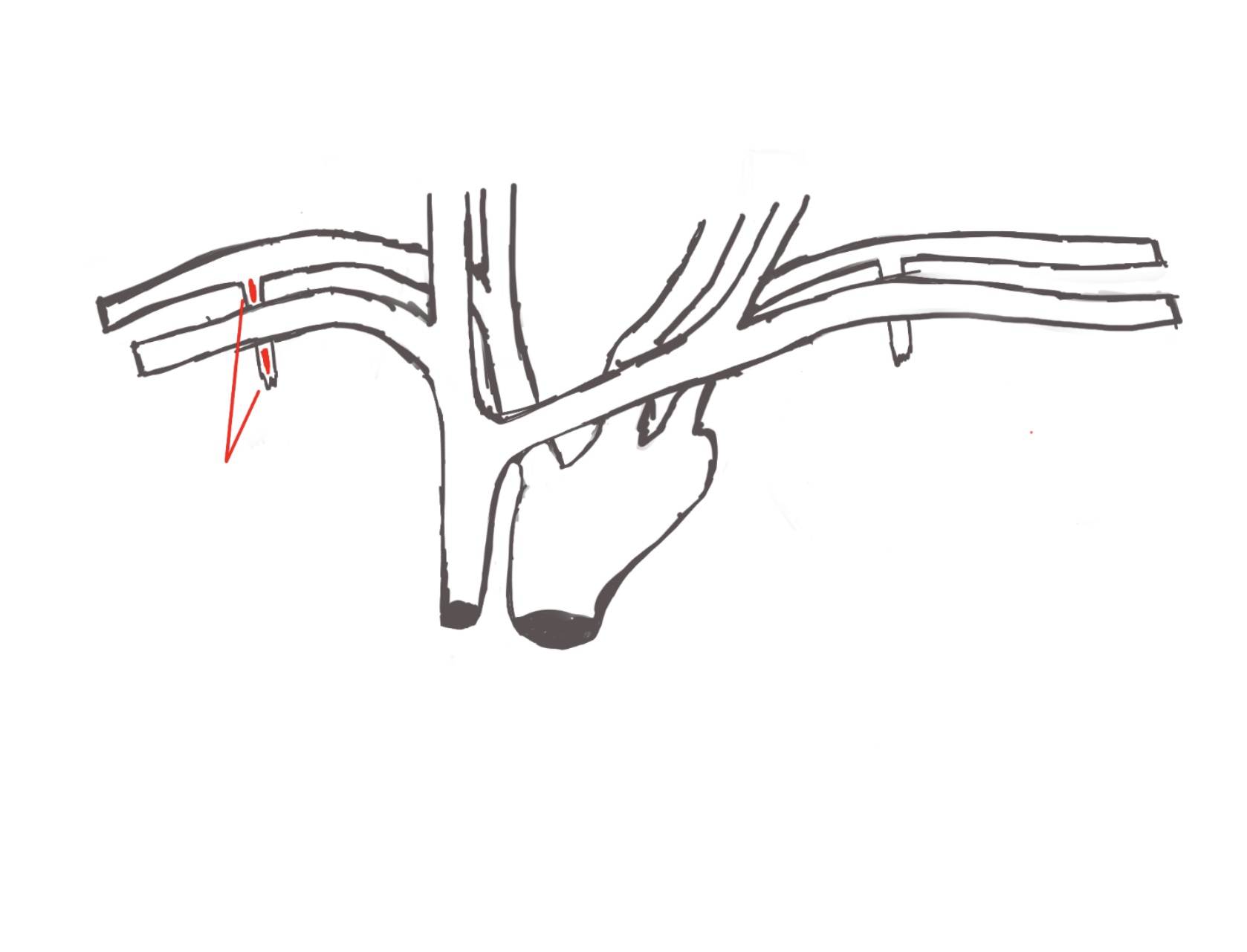 <p>structure. goes to thoracic cut.</p>