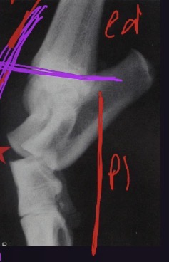 <p>What view is this? What part of the joint can be seen?</p>