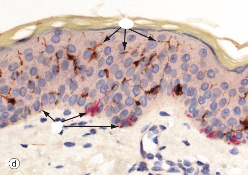 <p>Identify the Structure on top</p>