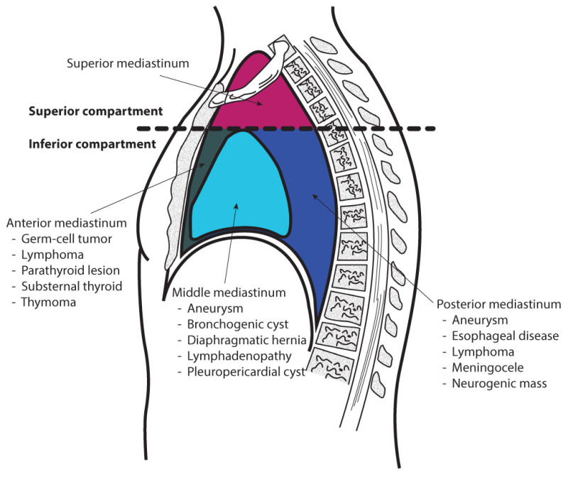 <p><span style="background-color: transparent; font-family: "Times New Roman", serif;"><strong>Division:</strong> Divided into <strong>Superior</strong> and <strong>Inferior</strong> by a plane through the sternal angle (Angle of Louis) to T4/T5.</span></p>