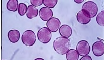 <p>Type of pollen? </p>