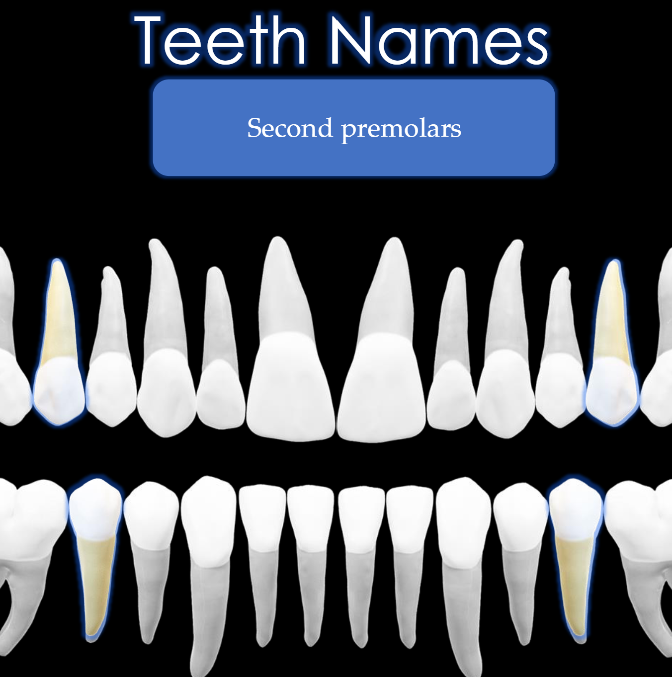 <p>Teeth #: 4,13, 20, 29</p>