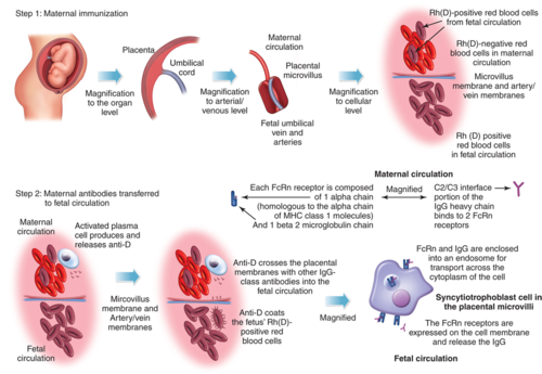 <ol><li><p>Mother Rh specific Bcells detect foestus’ different RhD group in its RBCs</p></li><li><p>Rh specific Bcell forms plasma cells and memory cellls</p></li><li><p>Plasma cells form Anti Rh IgM</p></li><li><p>Memory cells release IgG</p></li><li><p>IgG can cross placenta, attcking foetal RBCs</p></li></ol><p></p>