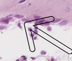 term image