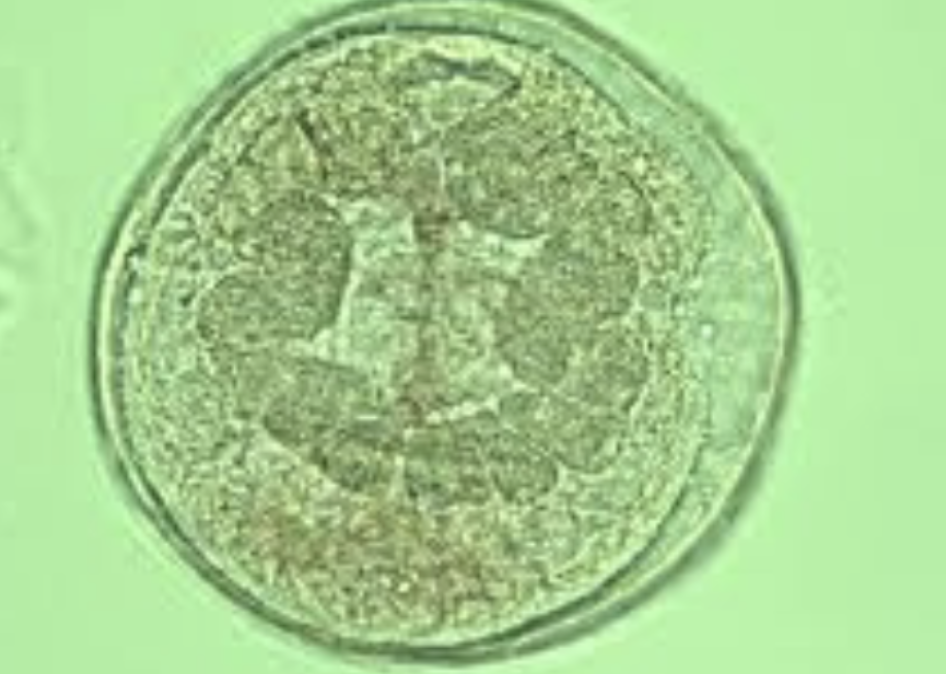 <p>What stage is this fluke at in the fluke life cycle?</p>