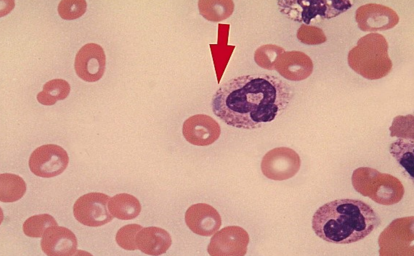 <p>what are dohle bodies?</p>