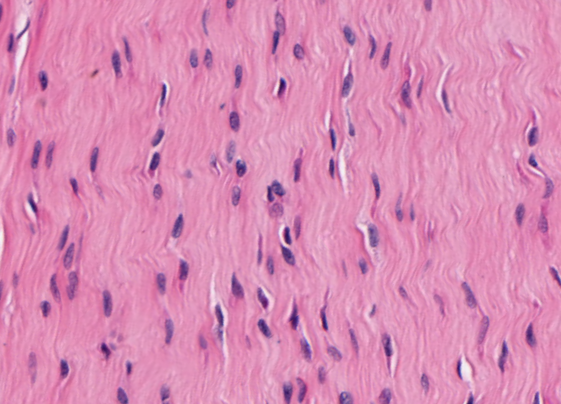 <p>What tissue type is this?</p>