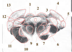 <p>What level of the brainstem is this</p>