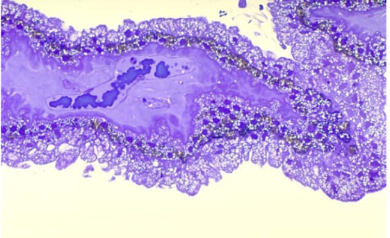<p>structure of the pars plicata </p>