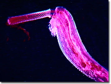 <p>What Phylum does this organism belong too</p>