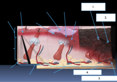 <p>What part of the burned skin model is the section labeled #4?</p>