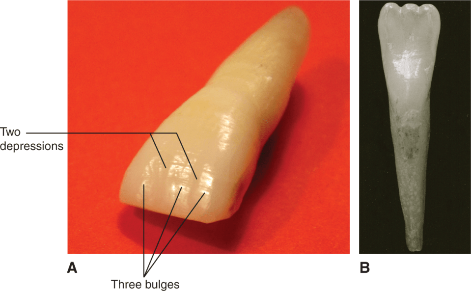 <p>mesiolabial & distolabial developmental depressions</p>