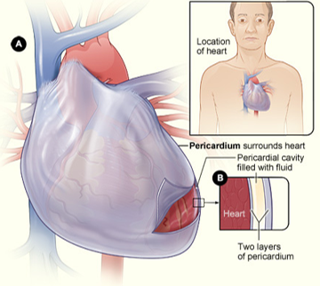 <p><span>It attaches to connective tissue between the lungs.</span></p>