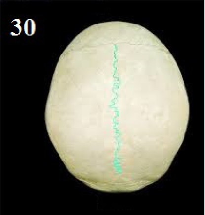<p>Name this suture.</p>