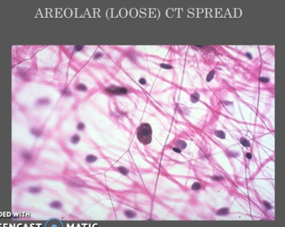 <ul><li><p>Loose (areolar)</p><ul><li><p>A few fibers, loosely arranged</p></li></ul></li><li><p>Dense</p><ul><li><p>Abundance of fibers, compactly arranged, very little ground substance</p></li><li><p>Dense irregular- support in different directions</p></li><li><p>Dense regular- support in one direction</p></li></ul></li></ul><p></p>