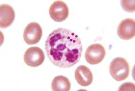 <p>name the white blood cell</p>