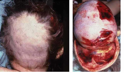 <p>Mention the type of child abuse?</p>