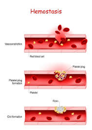 <p>Three steps of hemostasis</p>