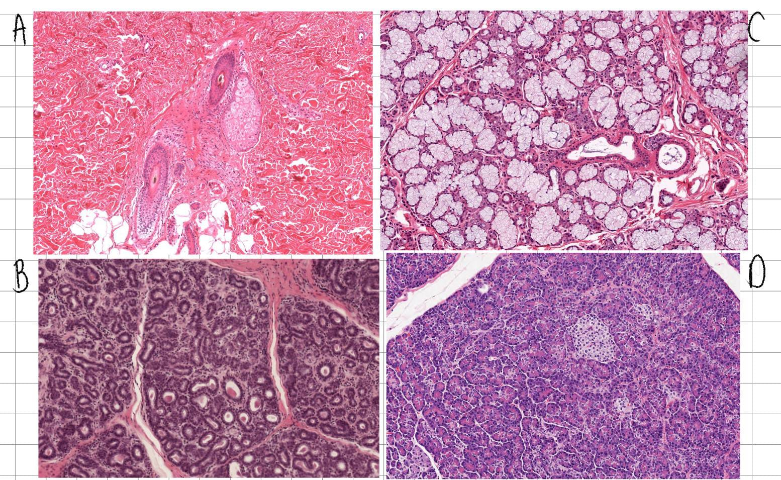 <p>Existen mecanismos de secreción glandular, el mecanismo que involucra <strong>pérdida de porción apical de células</strong> por ejemplo, en <u>glándulas mamarias</u>, ¿cuál imagen representa este tipo de secreción?</p>